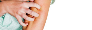 featured allergy article